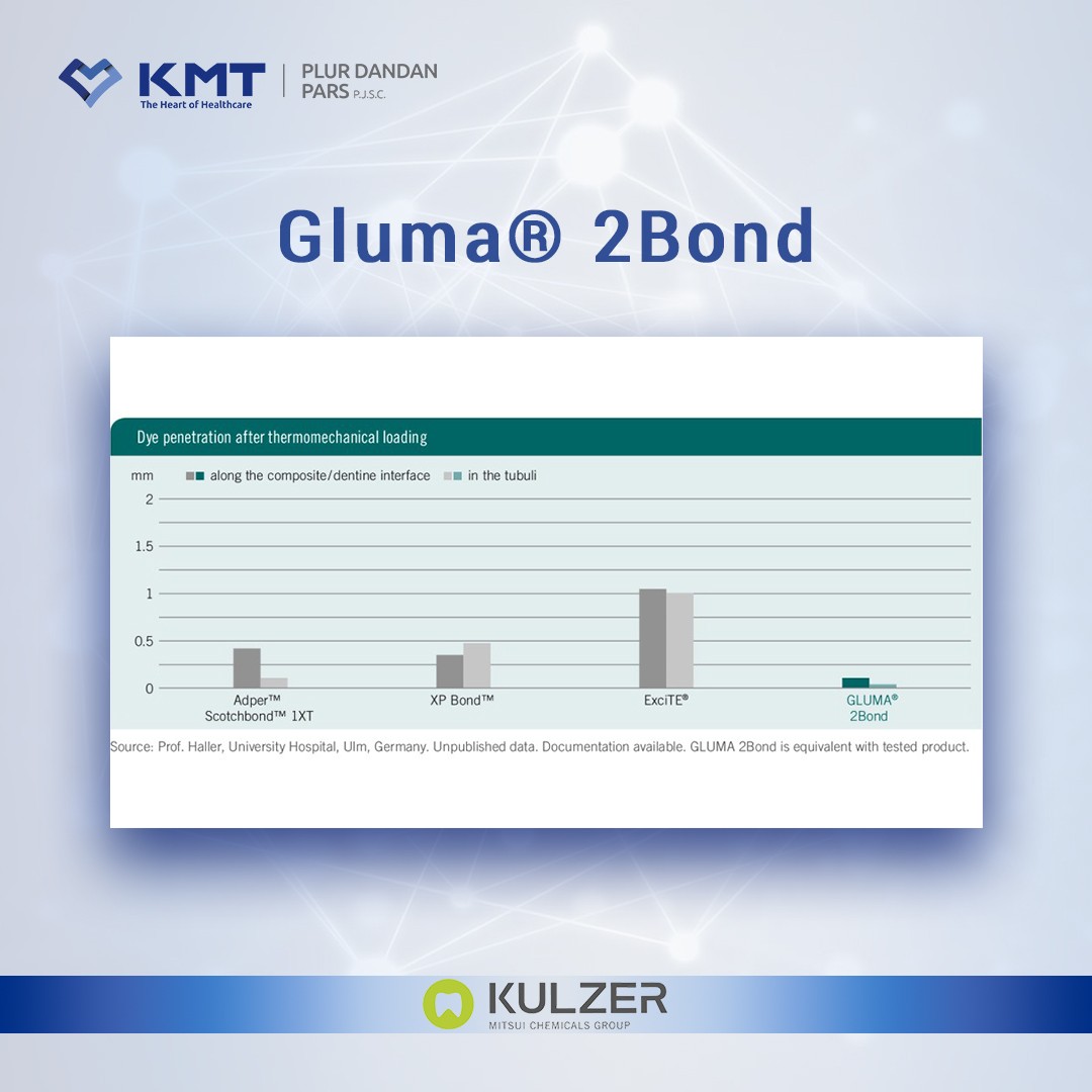 gluma 2 bond chart 1