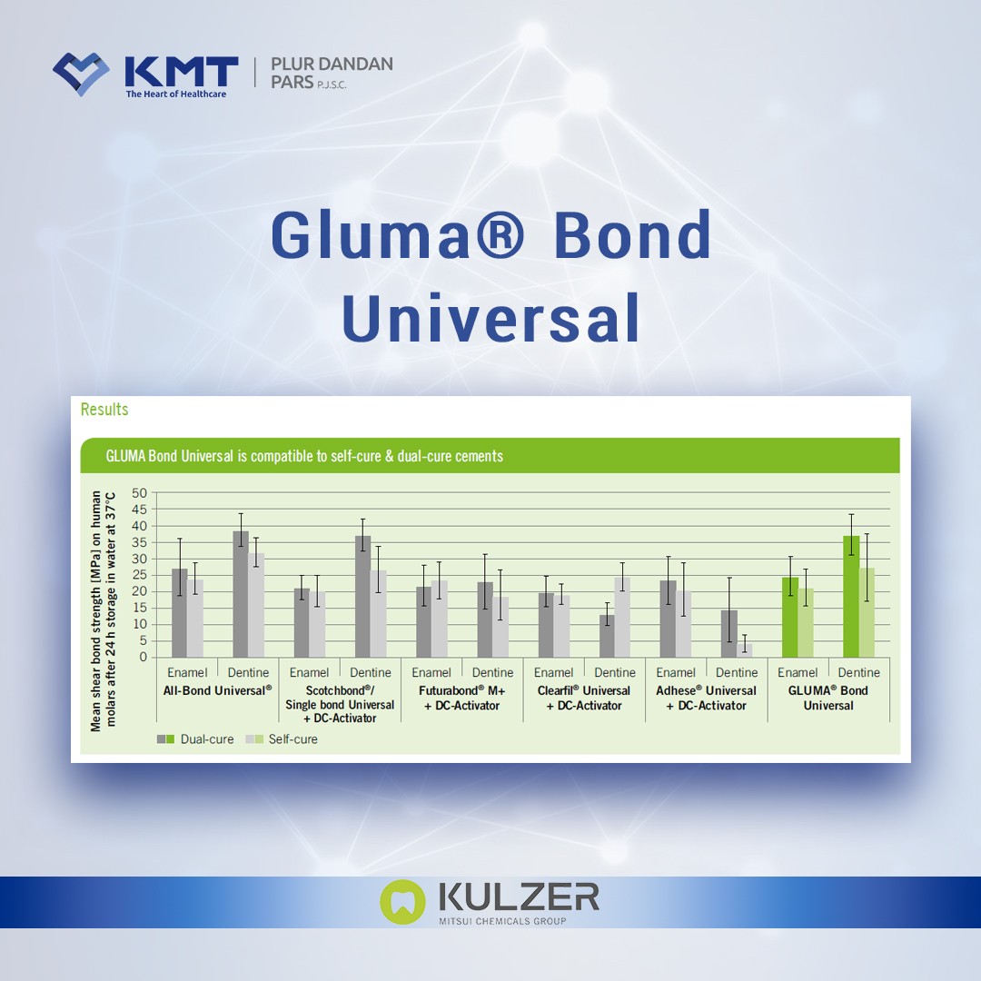 gluma bond universal chart  15