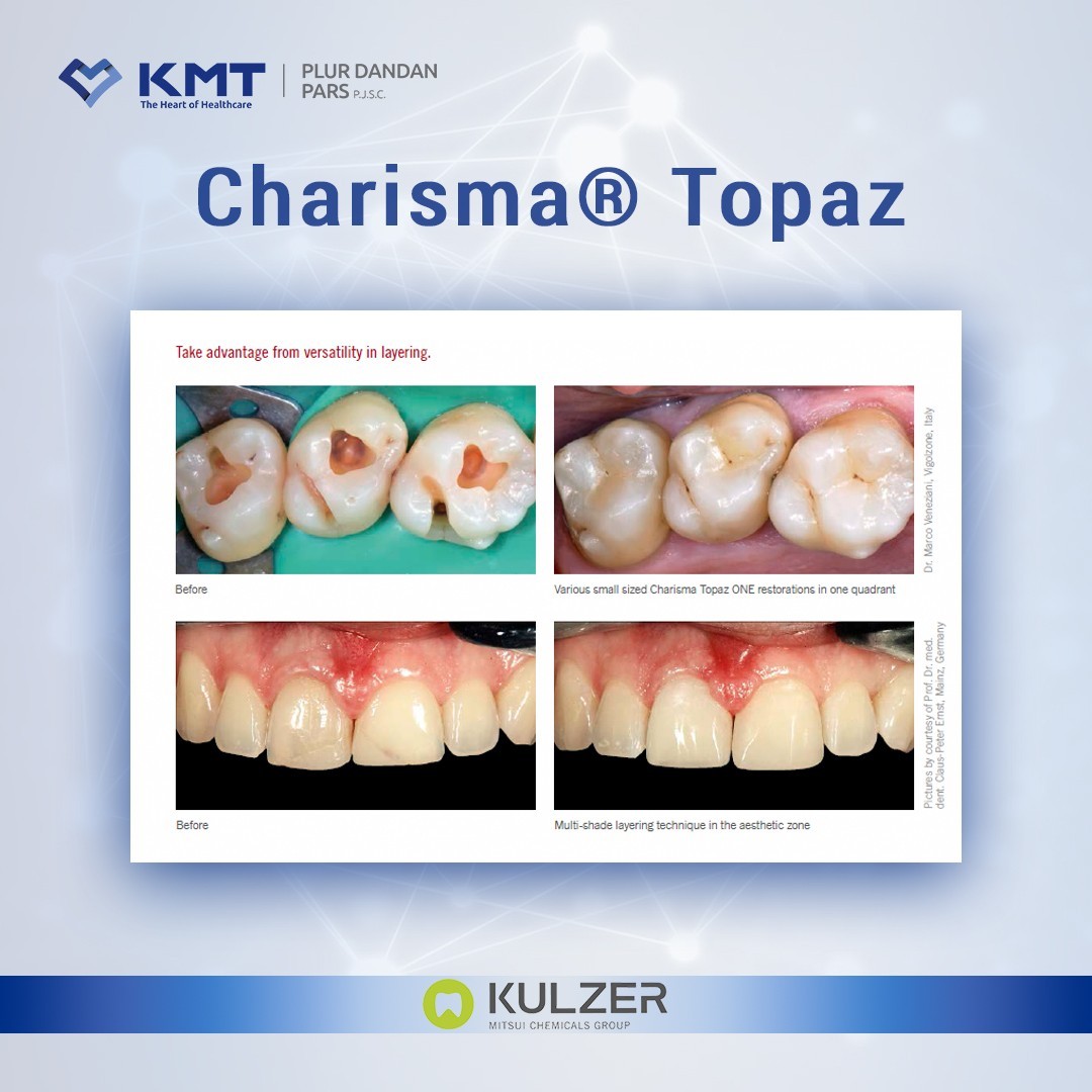 charisma topaz chart 5