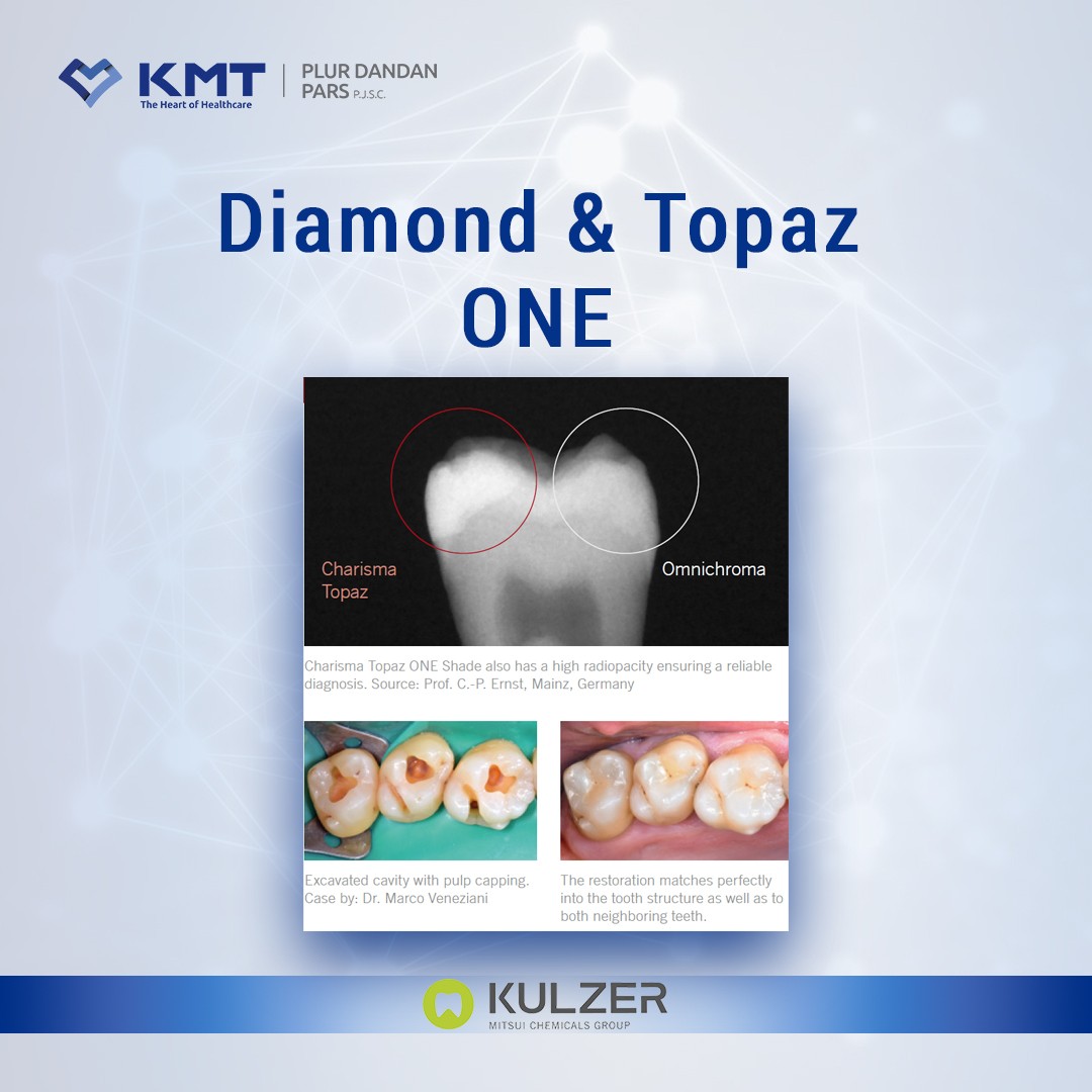 diamond & topaz one chart 9
