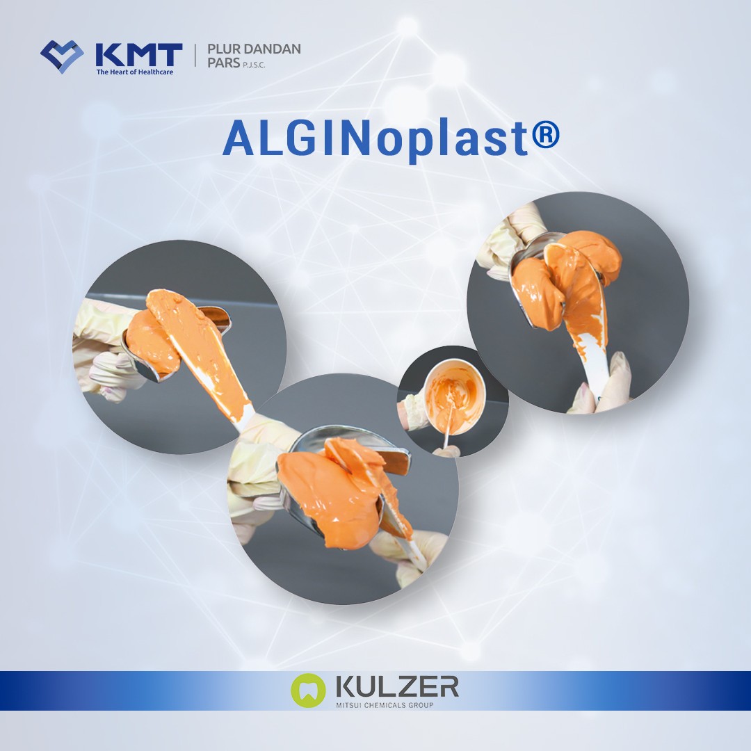 alginoplast chart 5