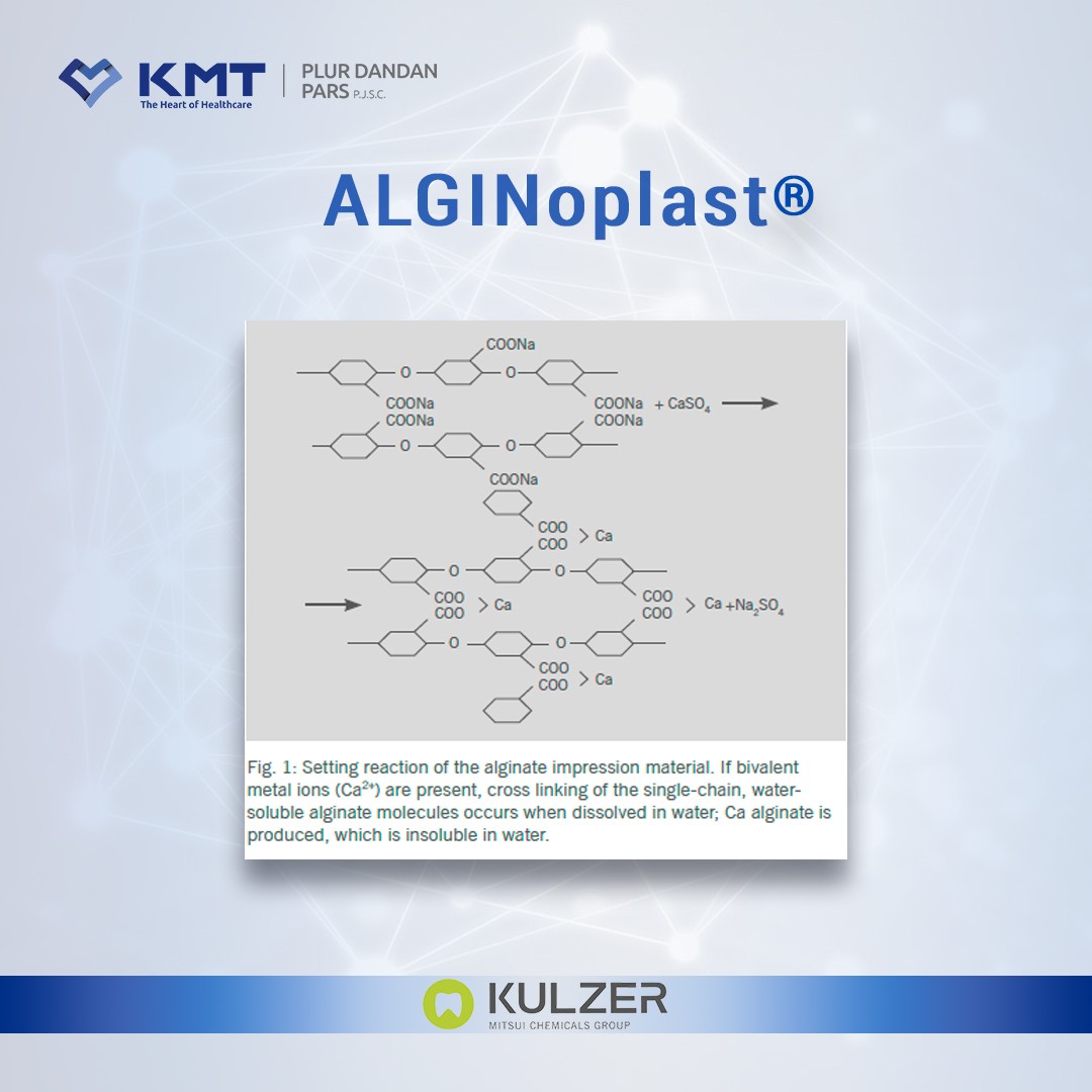 alginoplast chart 8
