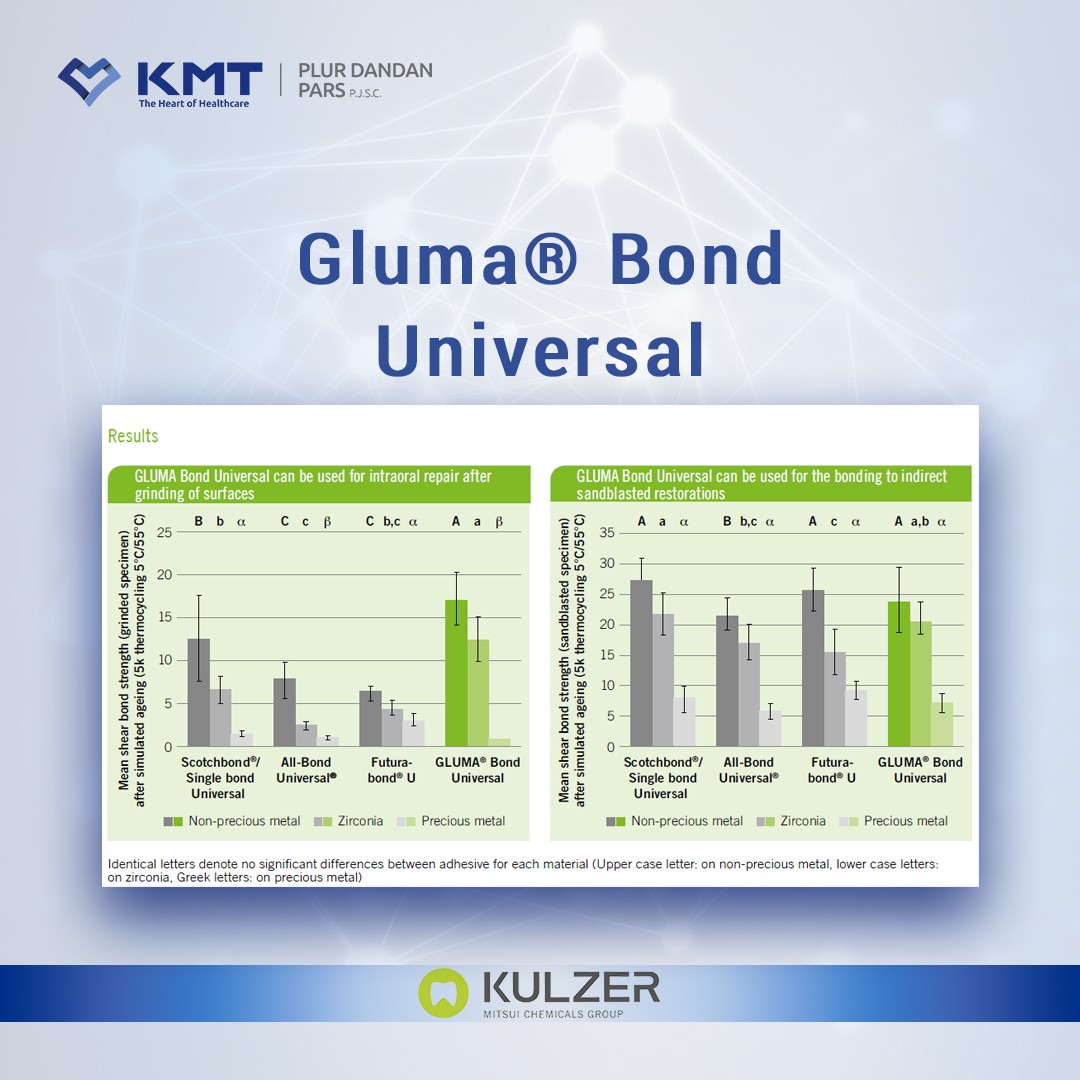 gluma bond universal chart  14