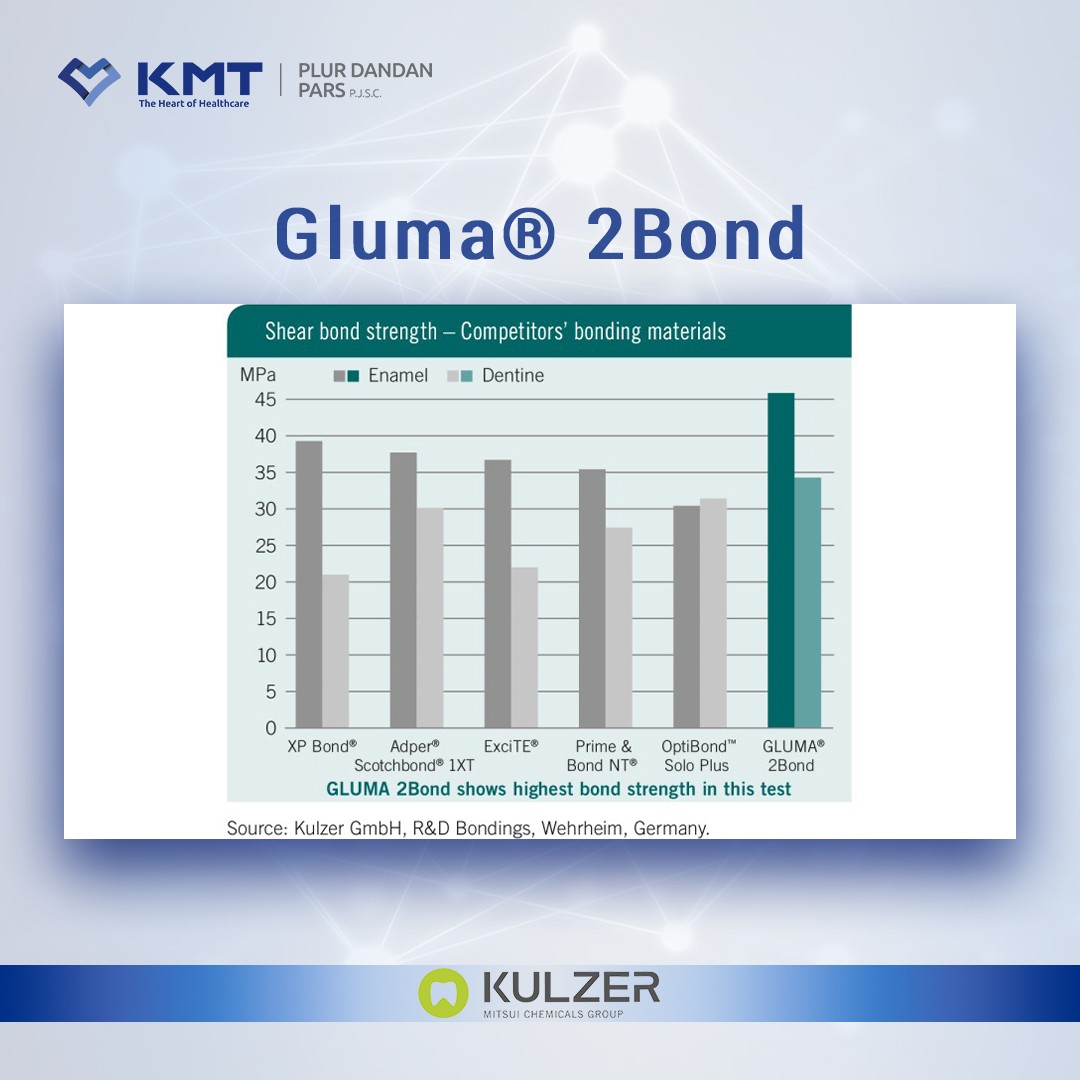 gluma 2 bond chart 2