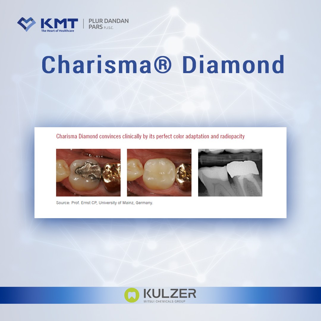 charisma diamond chart 6