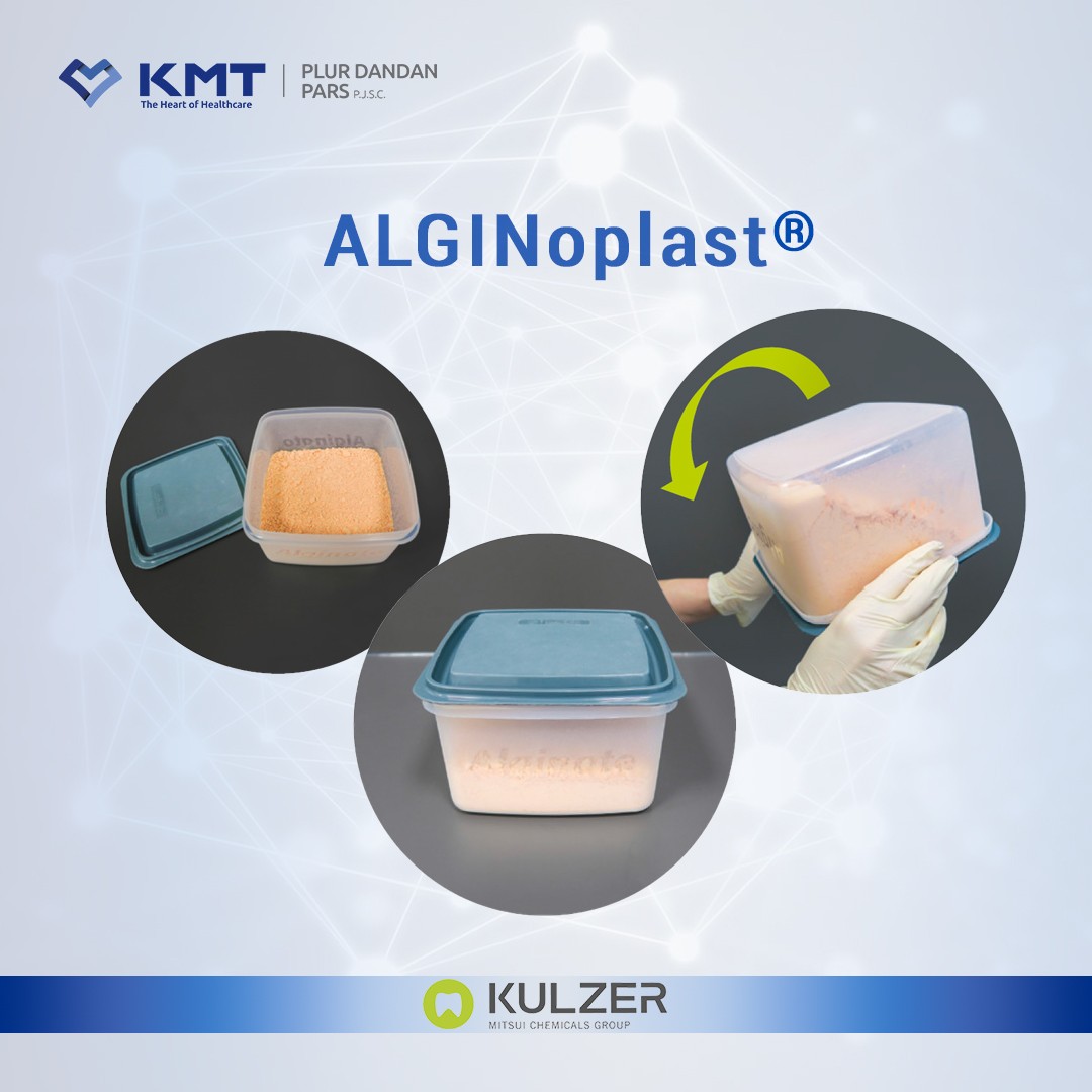 alginoplast chart 1