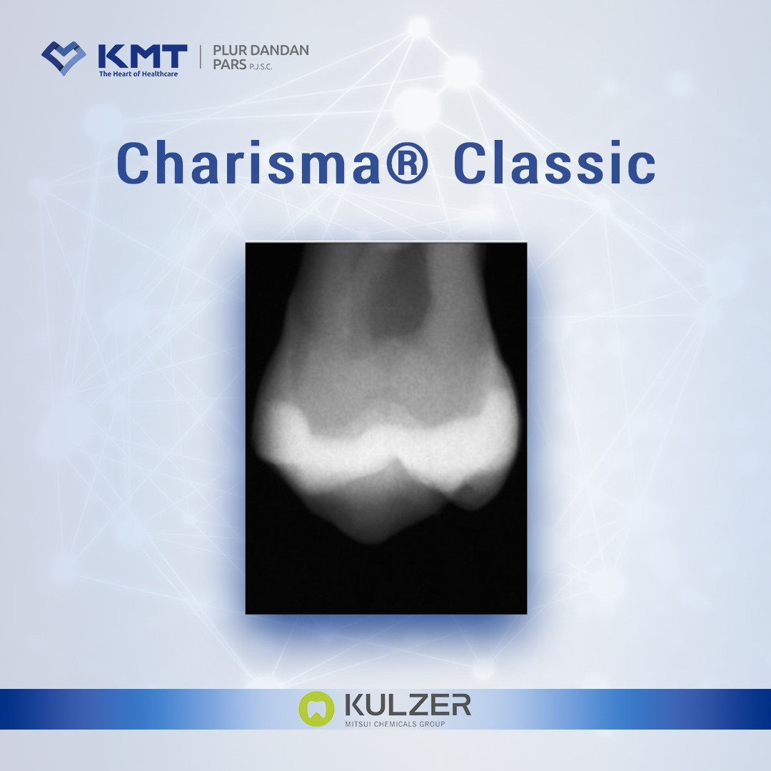 charisma classic chart 1