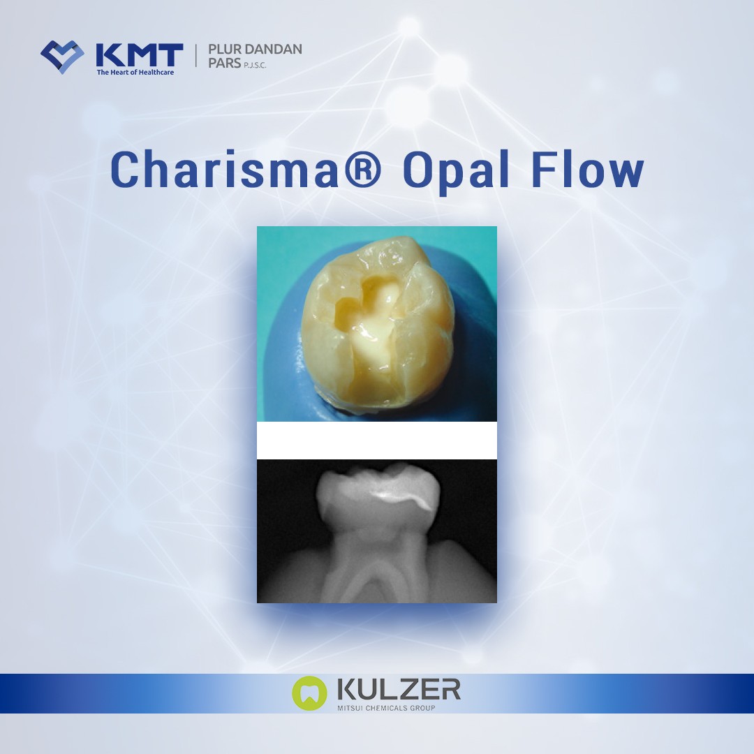 charisma opal flow chart 3