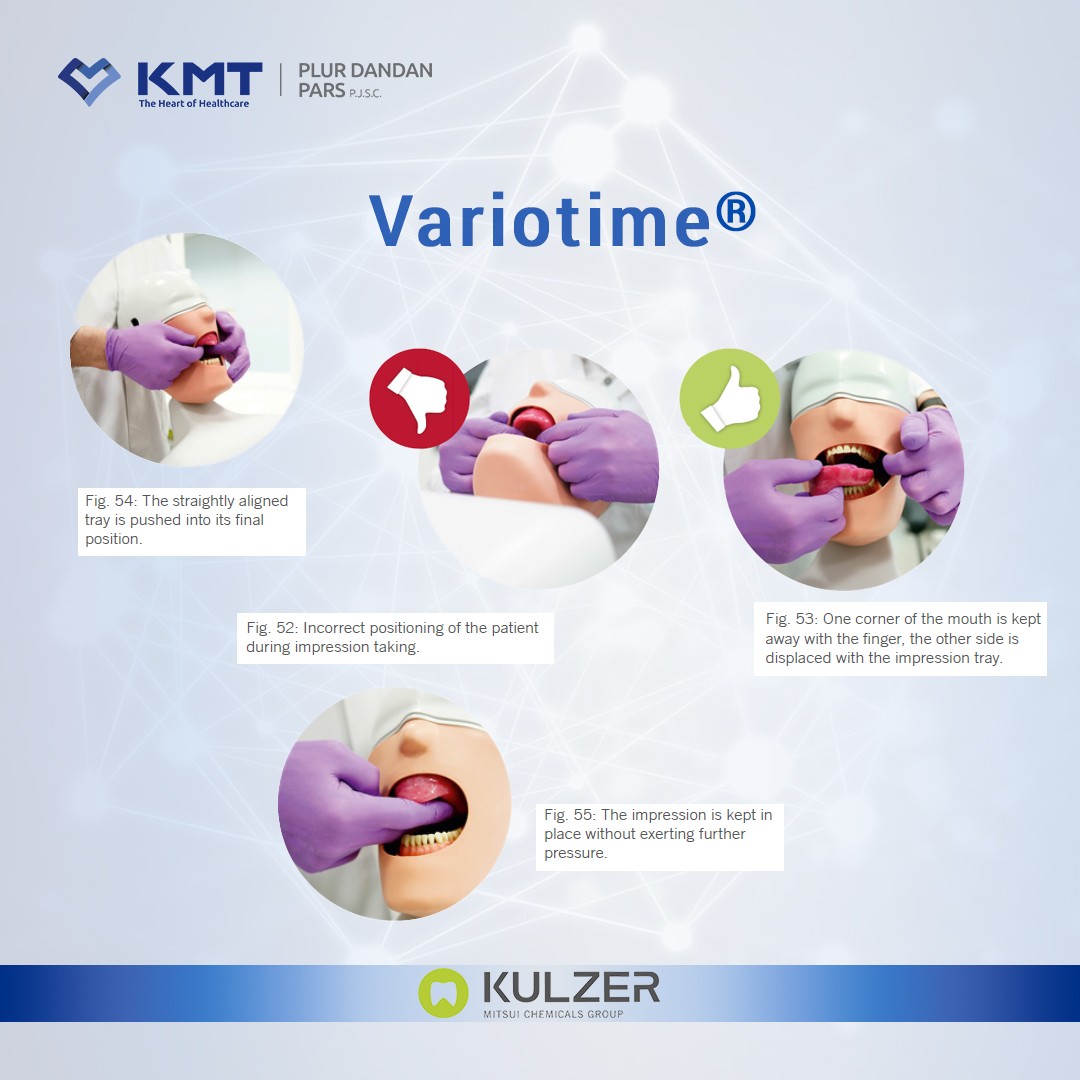 variotime 18