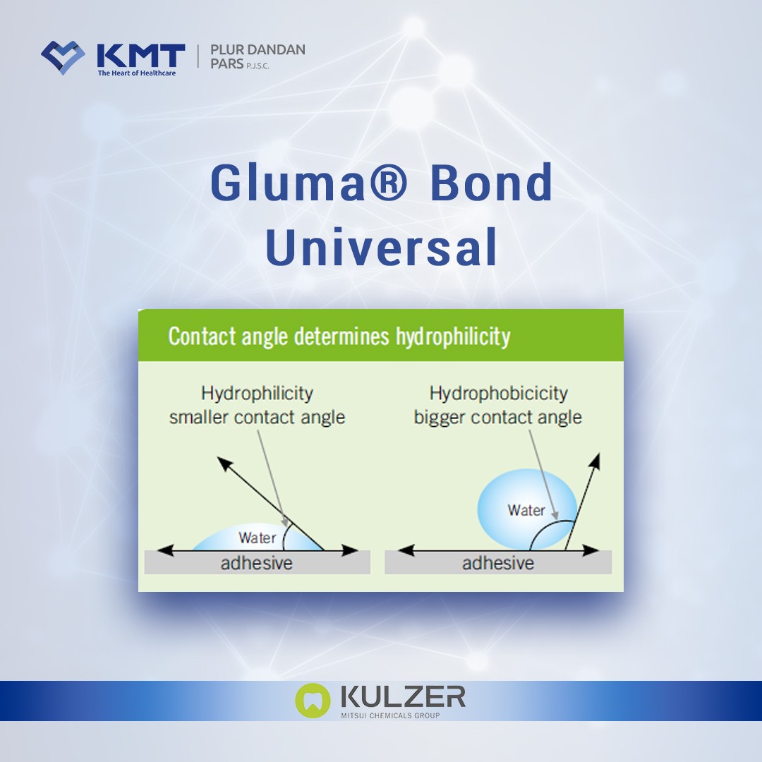 gluma bond universal chart  26