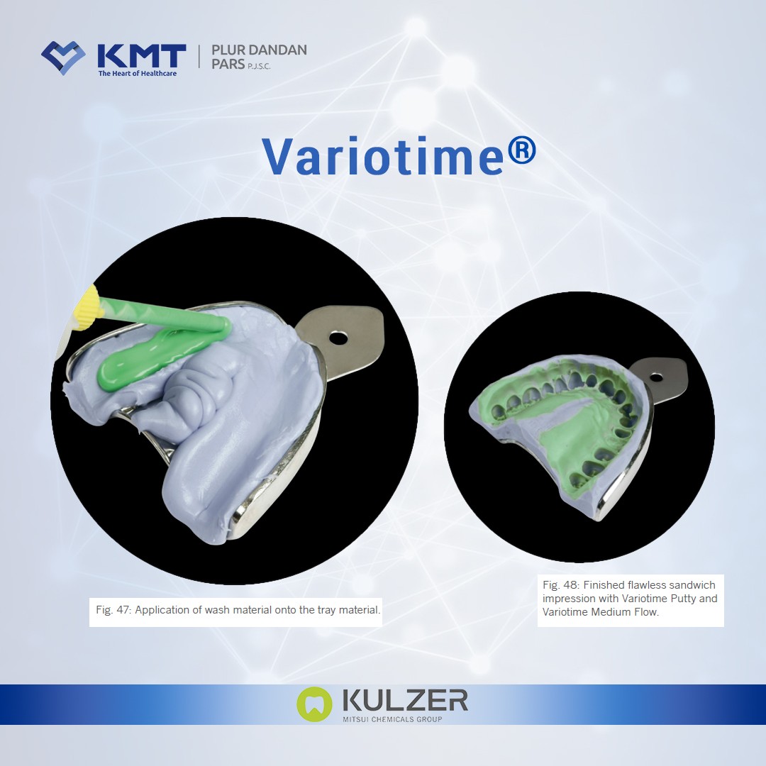 variotime 16