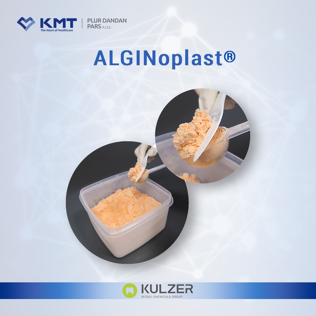 alginoplast chart 2