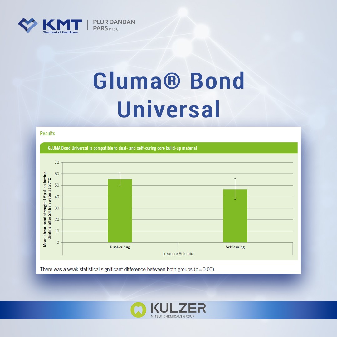 gluma bond universal chart  16
