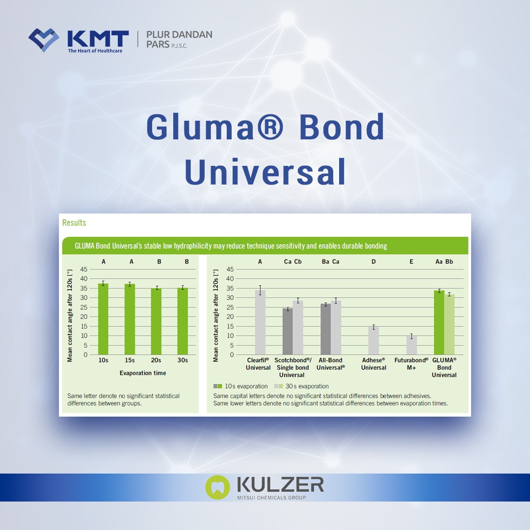 gluma bond universal chart  11