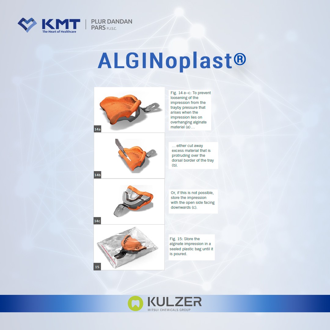 alginoplast chart 11