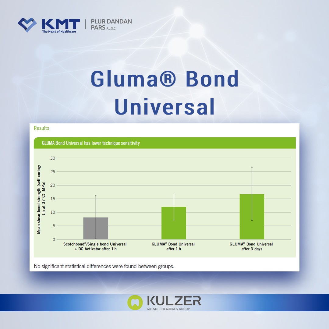 gluma bond universal chart  9