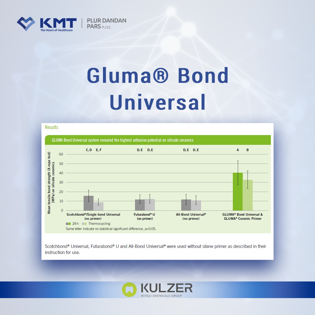 gluma bond universal chart  12