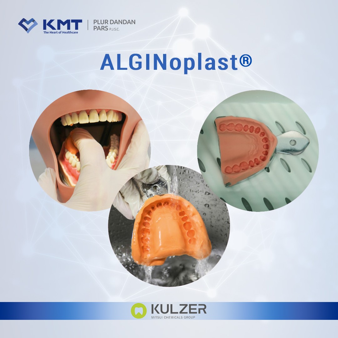 alginoplast chart 6
