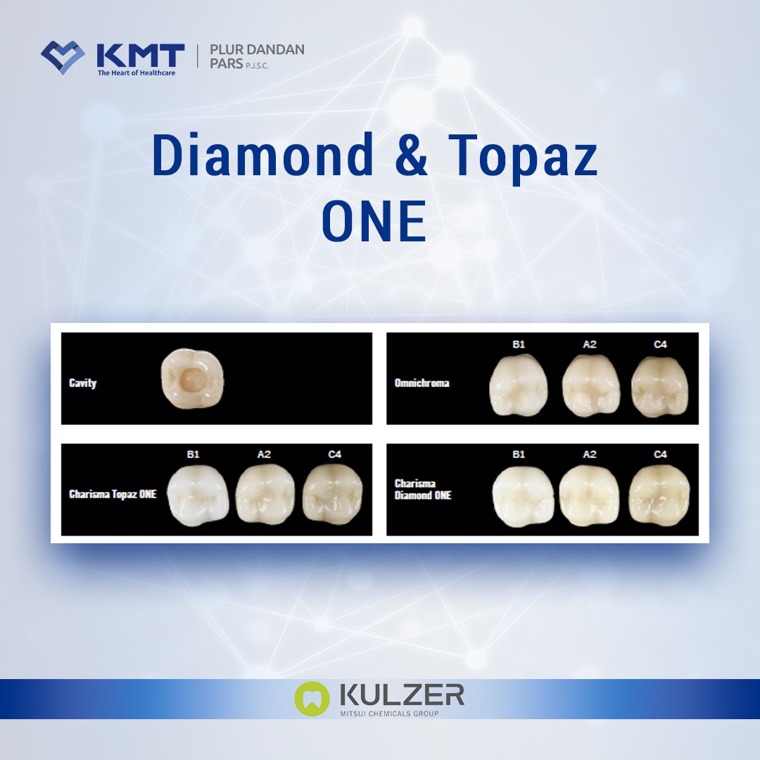 diamond & topaz one chart 2