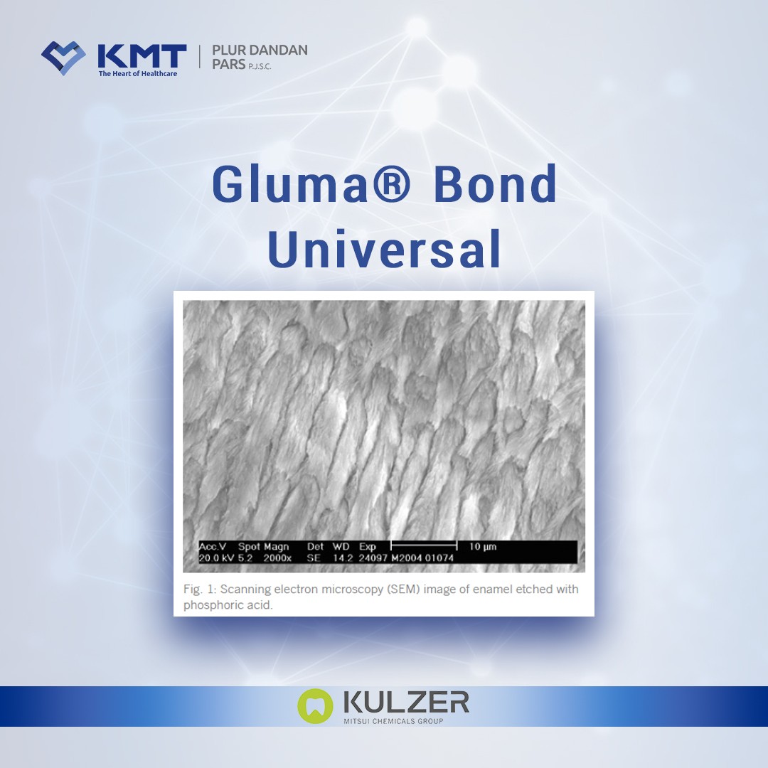 gluma bond universal chart  3