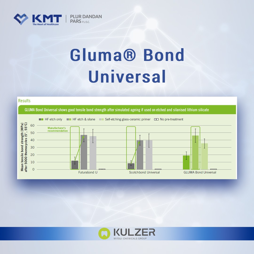 gluma bond universal chart 1