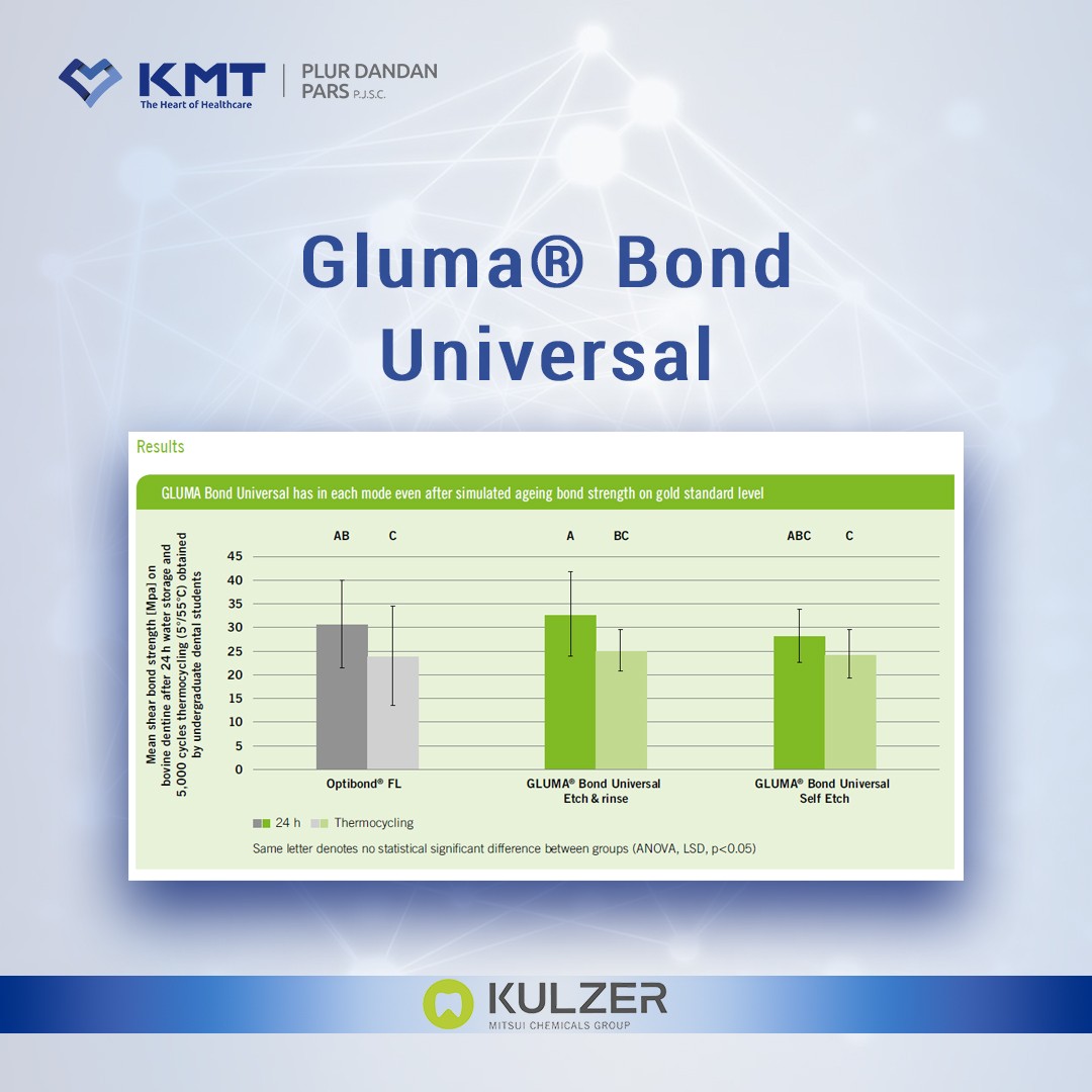 gluma bond universal chart  8